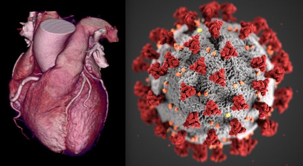 Covid Can Silently Steal Ur Heart: Can cause cardiac diseases in people without history, study