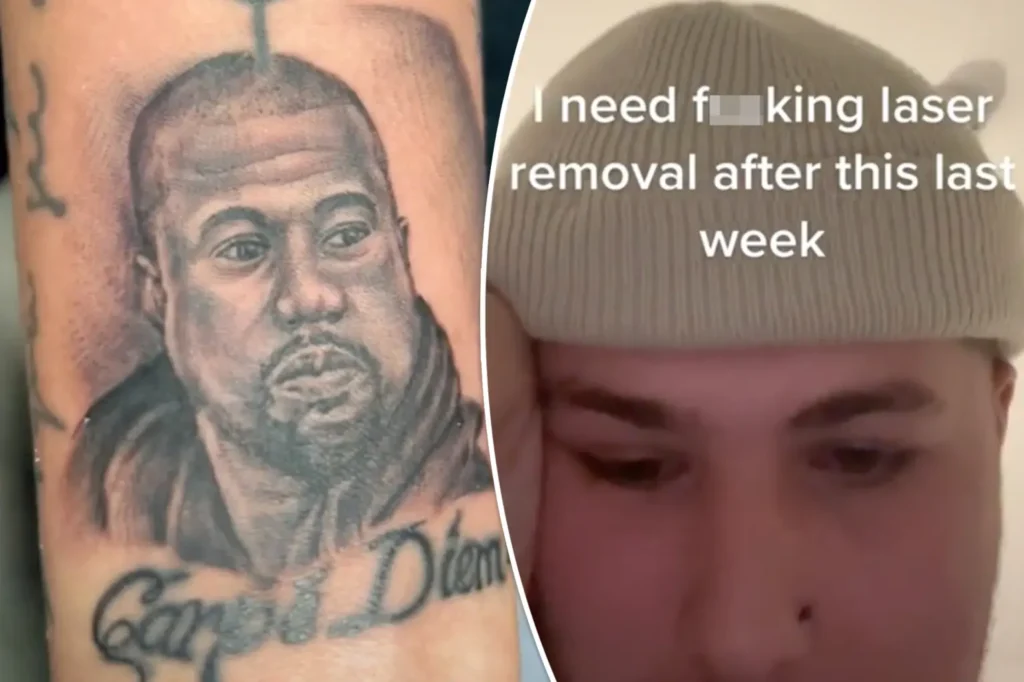 Kanye West tattoo removal is the hot new Google search, Fans Regret rapper’s tattoos