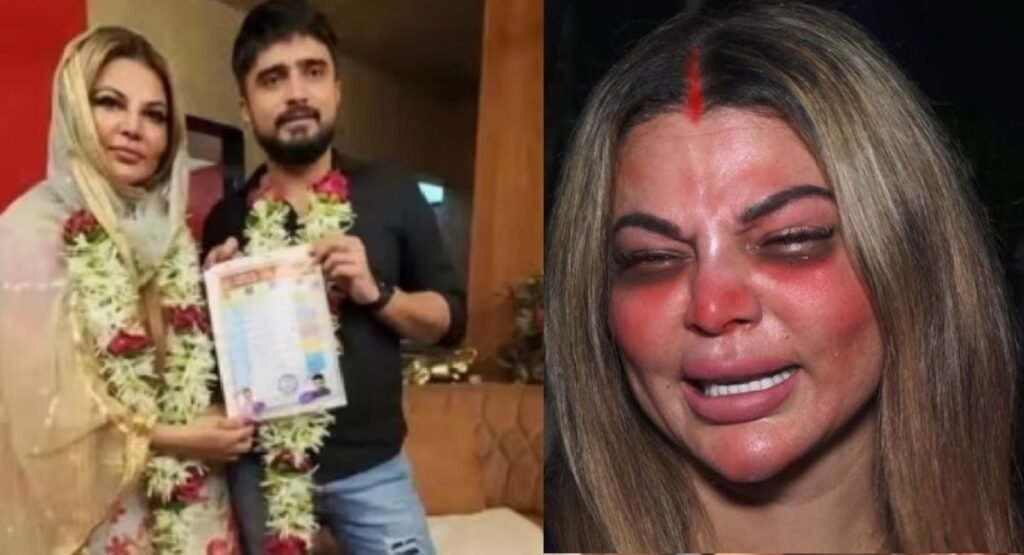 Rakhi Sawant Announces Separation From Husband Adil, Accuses him of domestic violence