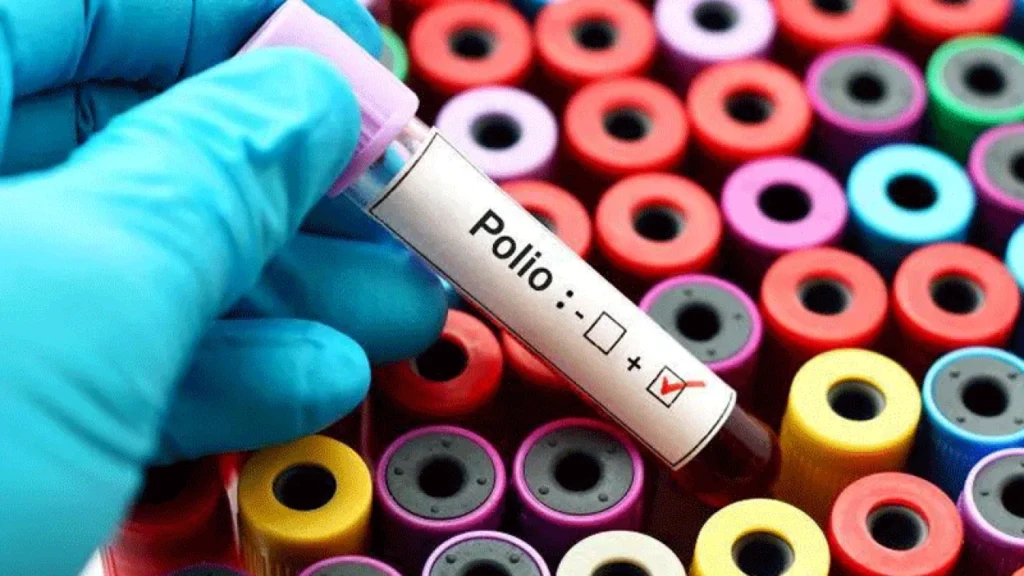 Detection of Polio Virus in Four Environmental Samples Raises Alarm
