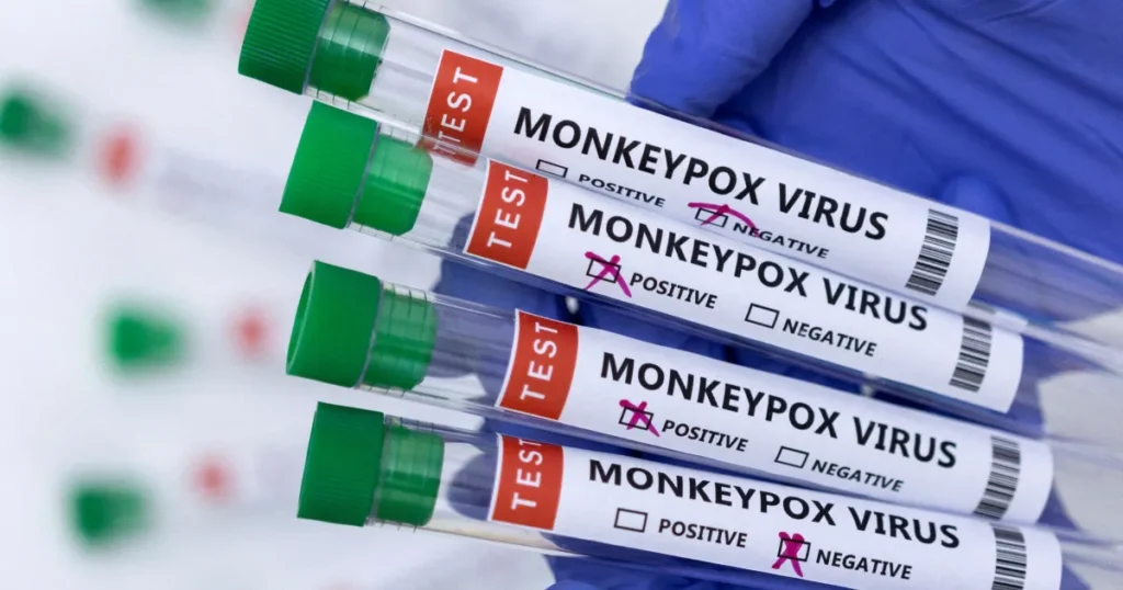 NCOC Issues Alert in Response to Increasing Global Monkeypox Cases