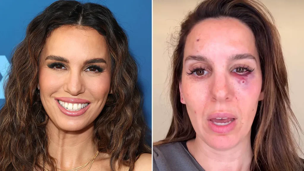 American Actress Christy Carlson Romano Injured in Shooting Incident During Trip
