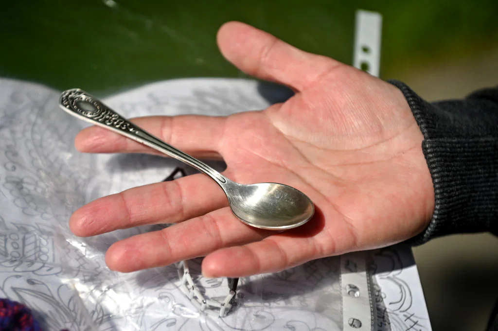 Ceramic spoon extracted from Chinese man’s intestine after six months