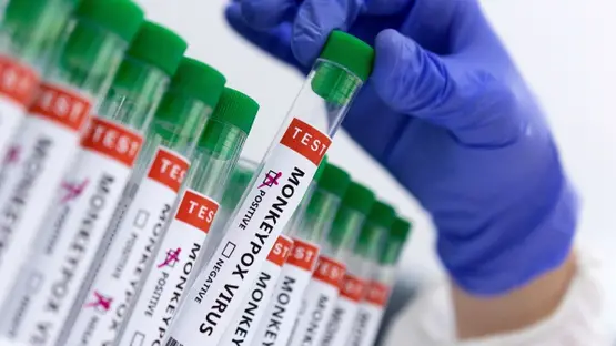 Gulf-Returned Man Tests Positive for Monkeypox in Pakistan