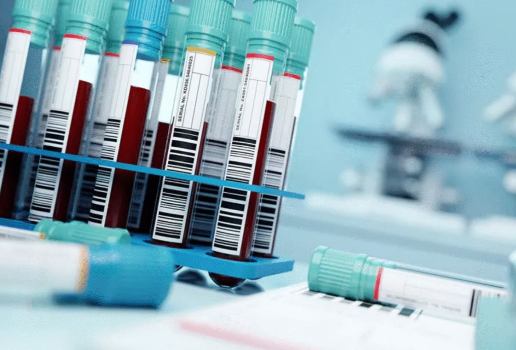 New Blood Test Can Detect Over 50 Types of Cancer Early blood test detects cancer early