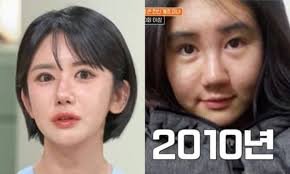 South Korean Woman Undergoes 400 Cosmetic Procedures Over 15 Years, Spends $210,000 on Transformation