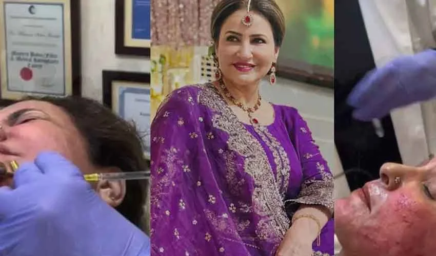 Saba Faisal’s face surgery video leaked Viral videos of Saba Faisal undergoing cosmetic treatments spark debate over beauty standards, aging, and celebrity pressure in showbiz.