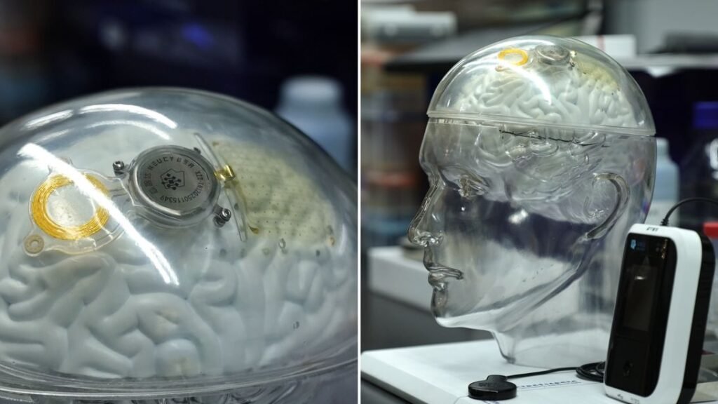 China Clears Brain-Computer Chip for Commercial Use, Intensifying Race With Neuralink