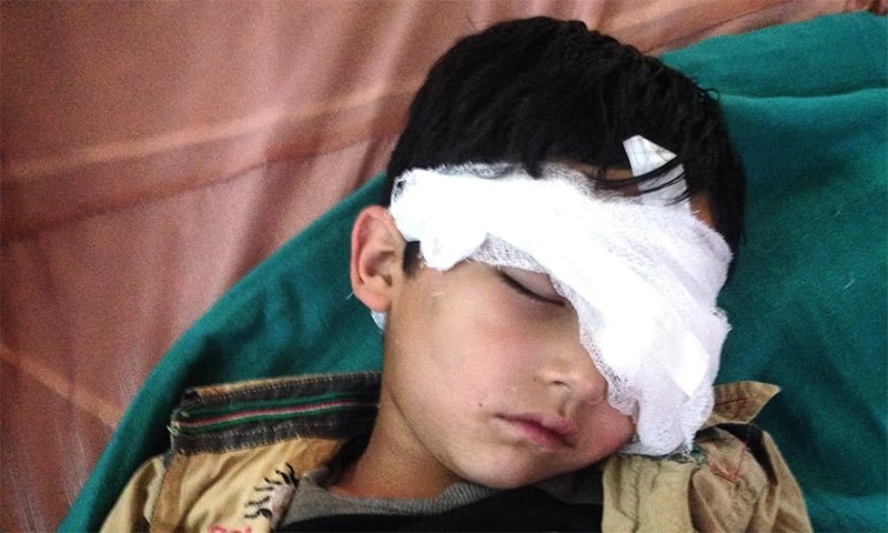 Upcoming Bollywood Film Sparks Anger Among Kashmir Pellet Victims Upcoming Bollywood Film Sparks Anger Among Kashmir Pellet Victims
