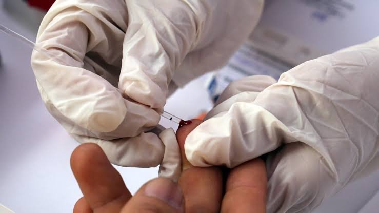One Hundred Adiala Jail Inmates Test HIV Positive HIV