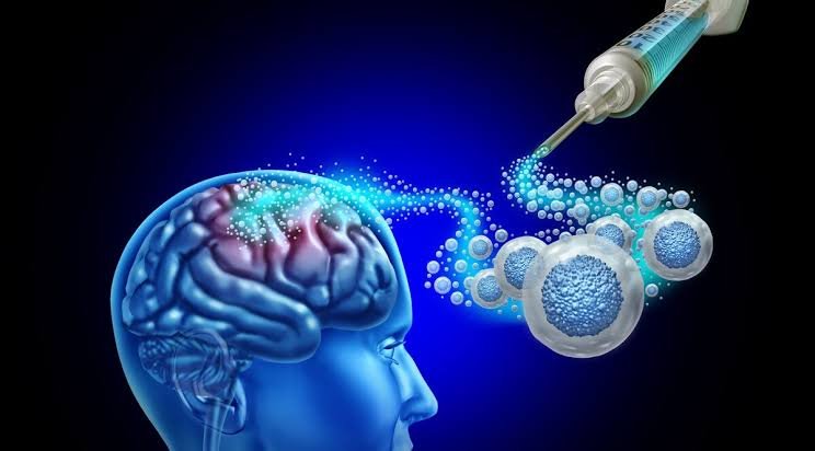 First Patient Receives Groundbreaking Stem Cell Treatment for Parkinson’s First Patient Receives Groundbreaking Stem Cell Treatment for Parkinson’s
