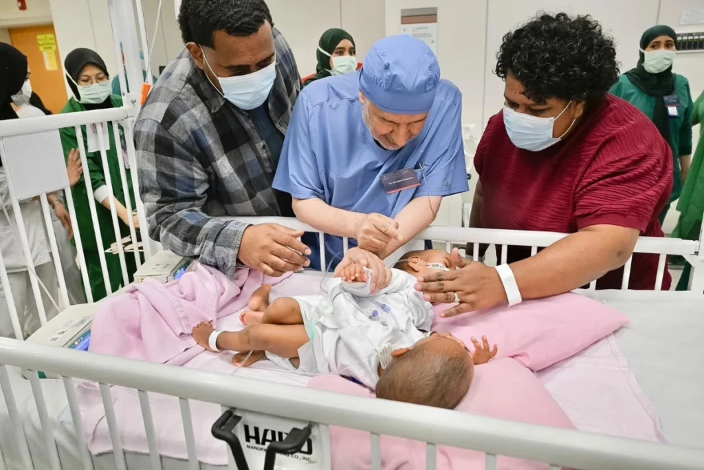 Fijian Conjoined Twins Separated Successfully After Nearly 13-Hour Surgery in Saudi Arabia Fijian Conjoined Twins Separated Successfully After Nearly 13-Hour Surgery in Saudi Arabia